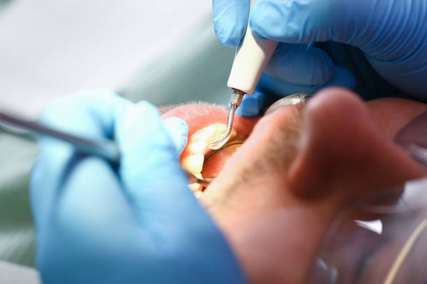Best Pediatric Emergency Dentist in Lake Shastina, CA