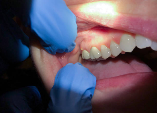 Best Same-Day Emergency Dental Services in Lake Shastina, CA